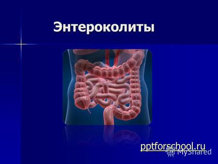 Энтероколиты pptforschool.ru. Хронический энтероколит – хроническое воспалительно- дистрофическое заболевание толстого и тонкого кишечника, приводящее.