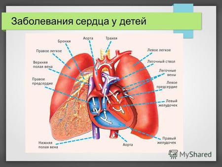 Заболевания сердца у детей. Пороки сердца (врожденные и приобретенные) Аритмии Воспалительные и аутоиммунные заболевания Кардиомиопатии.
