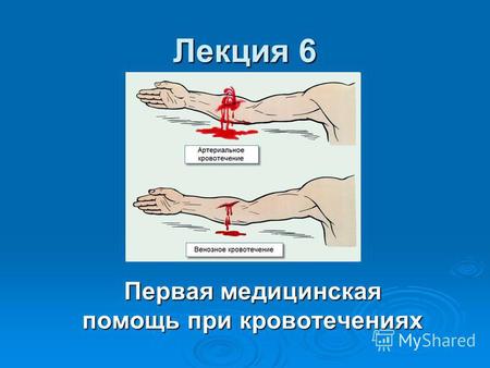 Лекция 6 Первая медицинская помощь при кровотечениях.