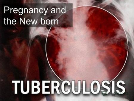 Pregnancy and the New born. Etiology is a highly infectious chronic disease caused by the TB bacilli. Mycobacterium Tuberculosis- acid fast bacillus Mode.