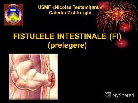 FISTULELE INTESTINALE (FI) (prelegere) USMF «Nicolae Testemiţanu» Catedra 2 chirurgie.