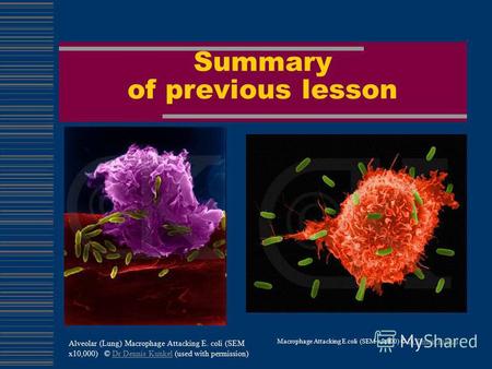 Summary of previous lesson Macrophage Attacking E.coli (SEM x8,800) © Dr Dennis KunkelDr Dennis Kunkel Alveolar (Lung) Macrophage Attacking E. coli (SEM.