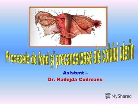 Asistent – Dr. Nadejda Codreanu. Cancerul de col apare pe colul patologic schimbat – importanţa proceselor de fond. 95% - apare din ţesutul pluristratificat.