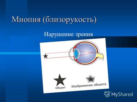 Миопия (близорукость) Нарушение зрения. Что такое миопия. Миопия (близорукость) - нарушение зрения, при котором человек хорошо видит предметы, расположенные.