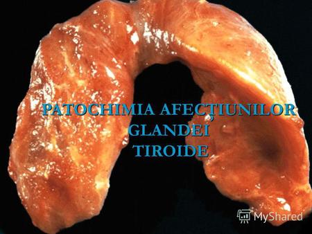 PATOCHIMIA AFECŢIUNILOR GLANDEI TIROIDE TIROIDE. Hormonii tiroidieni Sunt derivaţi ai AA: Sunt derivaţi ai AA: 1. T3- triiodtironina 2. T4- tiroxina,