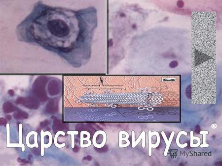 © Ви́рус (от лат. virus яд) микроскопическая частица, способная инфицировать клетки живых организмов. Вирусы не способны размножаться вне клетки. В настоящее.