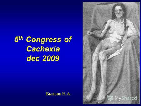 5 th Congress of Cachexia dec 2009 Былова Н.А.. Распространенность недостаточности питания в терапии ХСН- 48% ХПН-47% Онкология- 50% Гастроэнтерология-