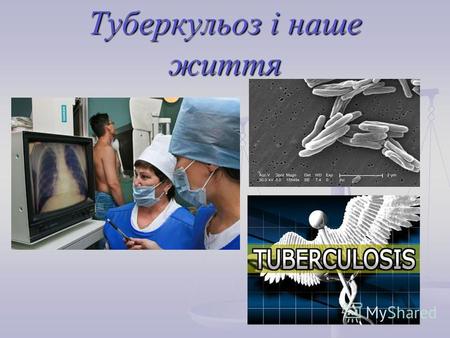 Туберкульоз і наше життя. Туберкульо́з Сухоти інфекційна хвороба, яка викликається мікробактеріями туберкульозу і характеризується утворенням специфічних.