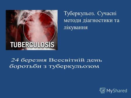 Туберкульоз. Сучасні методи діагностики та лікування.