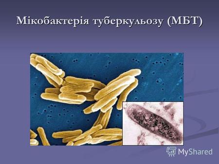 Мікобактерія туберкульозу (МБТ). Загальна характеристика МБТ МБТ була вперше описана у 1882 Робертом Кохом Ця бацила належить до родини актиноміцетів,