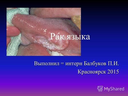 Рак языка Выполнил = интерн Балбуков П.И. Красноярск 2015.