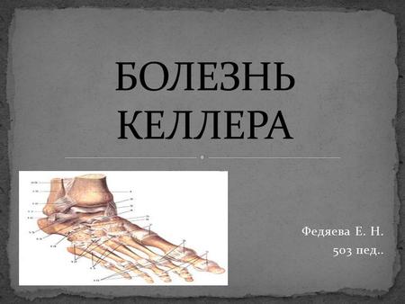 Федяева Е. Н. 503 пед... Болезнь Келлера это заболевание костей стопы, которое обычно встречается в детском и юношеском возрасте. Оно представляет собой.