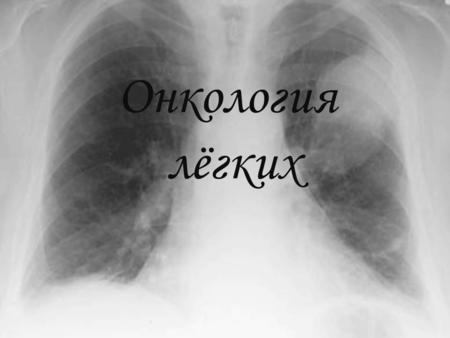 Онкология лёгких. Президент Российской академии медицинских наук Михаил Давыдов: Онкология - это крайняя степень загрязнения организма. В таком организме.