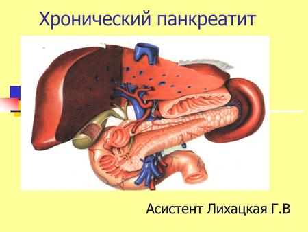 Хронический панкреатит Асистент Лихацкая Г.В. Хронический панкреатит - понятие, которое характеризует хроническое воспалительное повреждение ткани поджелудочной.
