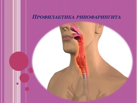 П РОФИЛАКТИКА РИНОФАРИНГИТА. Что такое ринофарингит? Ринофарингит представляет собой воспаление слизистых глотки и носа. Очень часто это заболевание путают.