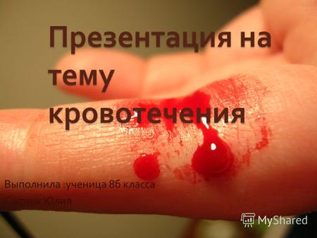 Презентация на тему кровотечения Выполнила : ученица 8 б класса Сытник Юлия.