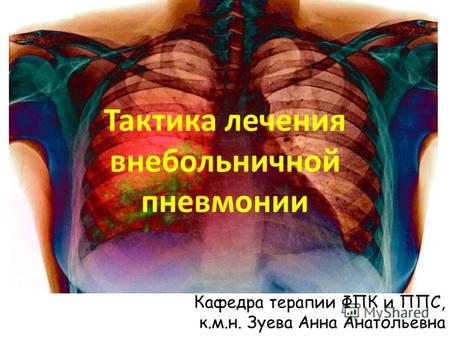 Тактика лечения внебольничной пневмонии Кафедра терапии ФПК и ППС, к.м.н. Зуева Анна Анатольевна.