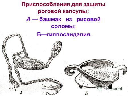 Приспособления для защиты роговой капсулы: А башмак из рисовой соломы; Бгиппосандалия.