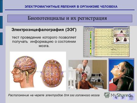 ЭЛЕКТРОМАГНИТНЫЕ ЯВЛЕНИЯ В ОРГАНИЗМЕ ЧЕЛОВЕКА Биопотенциалы и их регистрация Расположение на черепе электродов для ээг головного мозга Электроэнцефалография.