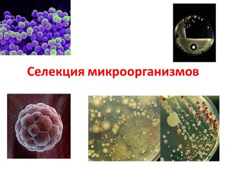 Селекция микроорганизмов. Микроорганизмы Бактерии, микроскопические грибы, простейшие.