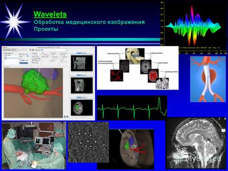 Wavelets Обработка медицинского изображения Проекты.