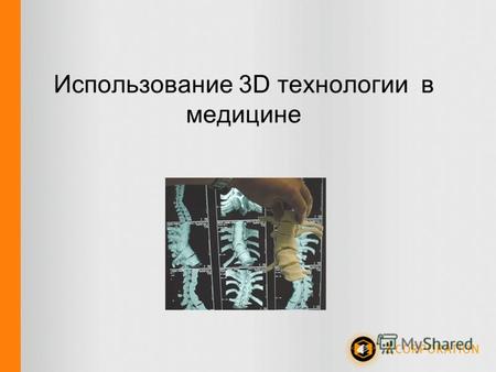 Использование 3D технологии в медицине. Медицинские 3D модели Технологии 3D печати позволяют врачам оперативно получать недорогие 3Д модели, для планирования.