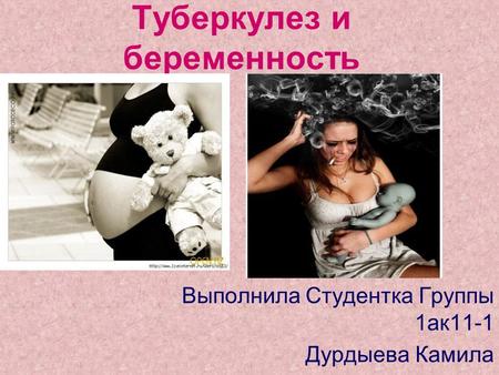 Туберкулез и беременность Выполнила Студентка Группы 1 ак 11-1 Дурдыева Камила.