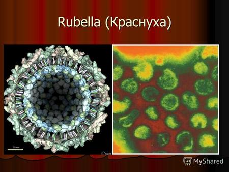 Rubella (Краснуха)Краснуха – острая вирусная антропонозная инфекция Проявляющаяся: Увеличением лимфатических узлов Увеличением лимфатических узлов мелкопятнистой.