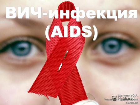 ВИЧ-инфекция (AIDS) Щетинина О.А. Читинский медицинский колледж.