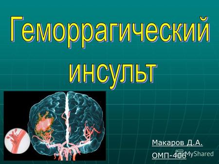 Макаров Д.А. ОМП-406. - это острое нарушение мозгового кровообращения, которое приводит к стойким нарушениям мозговой функции. По характеру патологического.