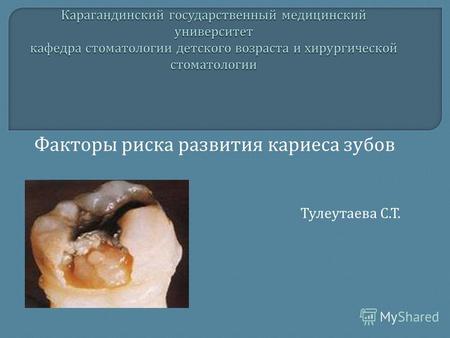 Факторы риска развития кариеса зубов Тулеутаева С. Т.