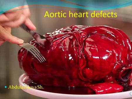 Aortic heart defects.Аортальные пороки сердца

