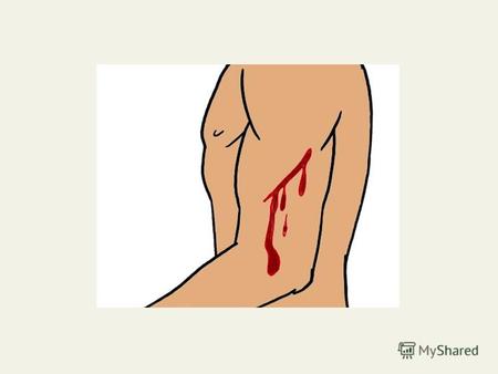 Тема урока «Оказание ПМП при различных видах кровотечений»