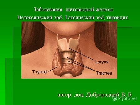 Заболевания щитовидной железы Нетоксический зоб. Токсический зоб, тироидит. автор: доц. Доброродний В. Б.
