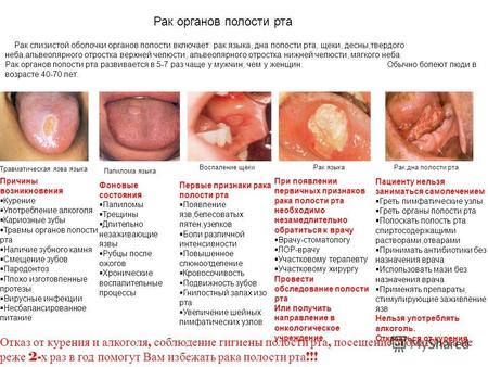 Рак слизистой оболочки органов полости включает: рак языка, дна полости рта, щеки, десны,твердого неба,альвеолярного отростка верхней челюсти, альвеолярного.