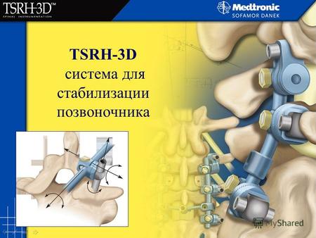 TSRH-3D система для стабилизации позвоночника. VBR Монтажные редукционные инструменты Vertebral Body Reduction.