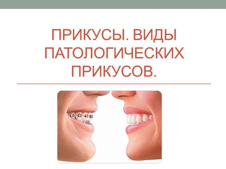 ПРИКУСЫ. ВИДЫ ПАТОЛОГИЧЕСКИХ ПРИКУСОВ.. Прикус взаимоотношение зубных рядов при максимальном контакте и полном смыкании зубов верхней и нижней челюстей.