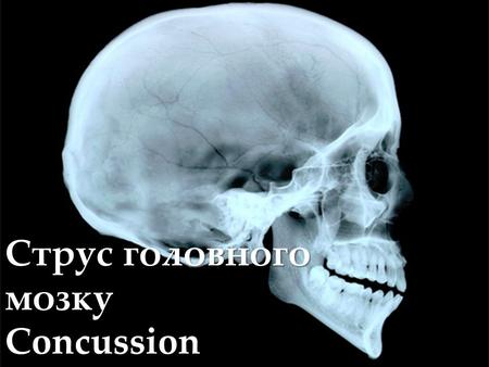 { Струс головного мозку Concussion. Струс мозку - найпоширеніше пошкодження голови. Звичайній людині відрізнити забій від струсу досить важко. При будь-якому.