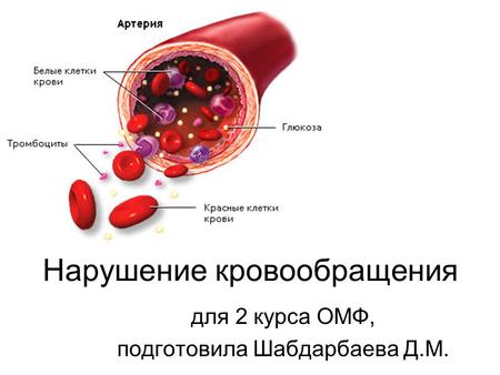 Нарушение кровообращения для 2 курса ОМФ, подготовила Шабдарбаева Д.М.