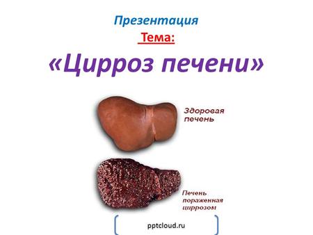 Презентация Тема: «Цирроз печени» pptcloud.ru. Цирроз печени – это хронический прогрессирующий процесс в печени, характеризующийся значительным снижением.