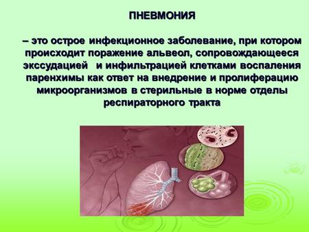 ПНЕВМОНИЯ – это острое инфекционное заболевание, при котором происходит поражение альвеол, сопровождающееся экссудацией и инфильтрацией клетками воспаления.
