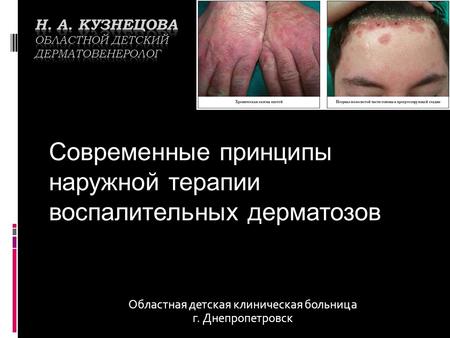 Областная детская клиническая больница г. Днепропетровск Современные принципы наружной терапии воспалительных дерматозов.