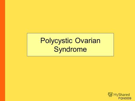 Polycystic Ovarian Syndrome FQN0009. Polycystic Ovarian Syndrome 1 st described by Irving Stein and Michael Leventhal as a triad of amenorrhea, obesity.