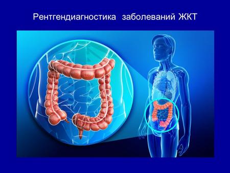 Рентгендиагностика заболеваний ЖКТ. Показания Боли в животе Нарушение пищеварения (тяжесть в желудке, изжога, тошнота, рвота) Расстройства стула (диарея,