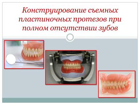 Конструирование съемных пластиночных протезов при полном отсутствии зубов.