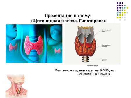 Презентация на тему: «Щитовидная железа. Гипотиреоз» Выполнила студентка группы 10 б 30 дес Решетняк Яна Юрьивна.