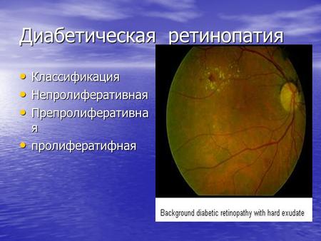 Диабетическая ретинопатия Классификация Классификация Непролиферативная Непролиферативная Препролиферативна я Препролиферативна я пролифератифная пролифератифная.
