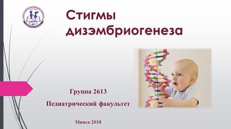 Стигмы дизэмбриогенеза Группа 2613 Педиатрический факультет Минск 2018.