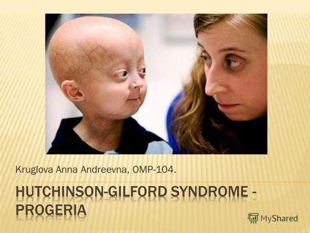 Hutchinson-Gilford syndrome - progeria