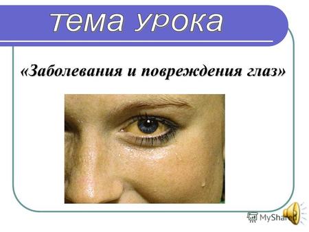 «Заболевания и повреждения глаз». 1. Познакомиться с различными заболеваниями глаз. 2. Раскрыть причины дальнозоркости и близорукости. 3. Выявить основные.